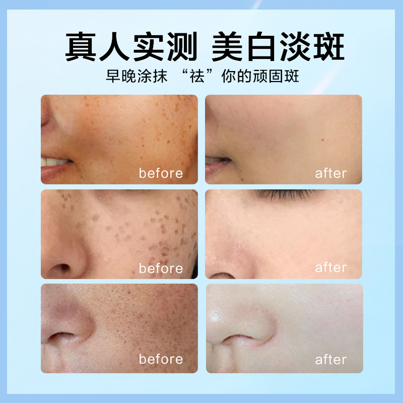 1776158603325116.jpg 爱心净润美白祛斑霜主图20g5.jpg